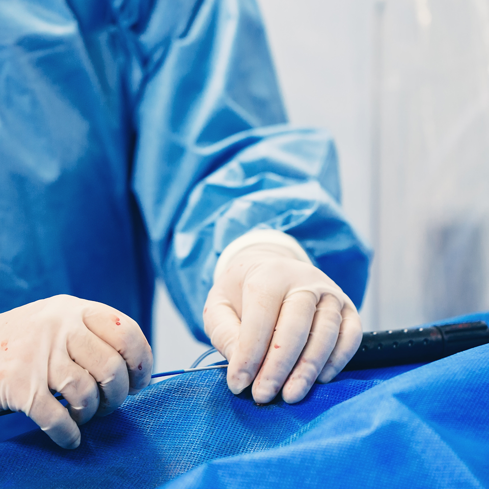 カテーテル治療(脳血管内治療)