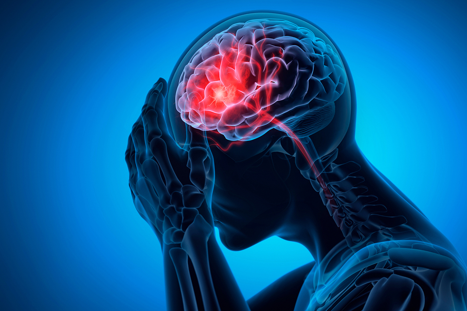 破裂脳動脈瘤の場合