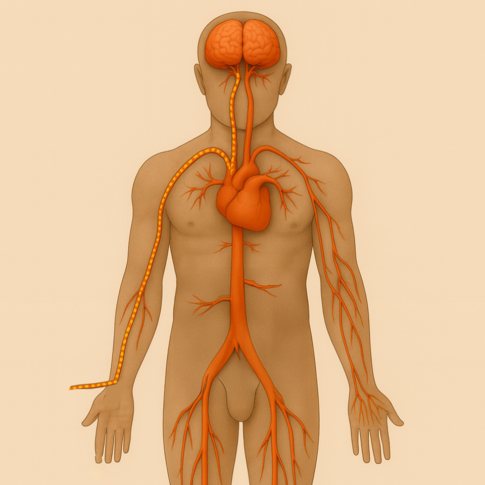 未破裂動脈瘤の場合