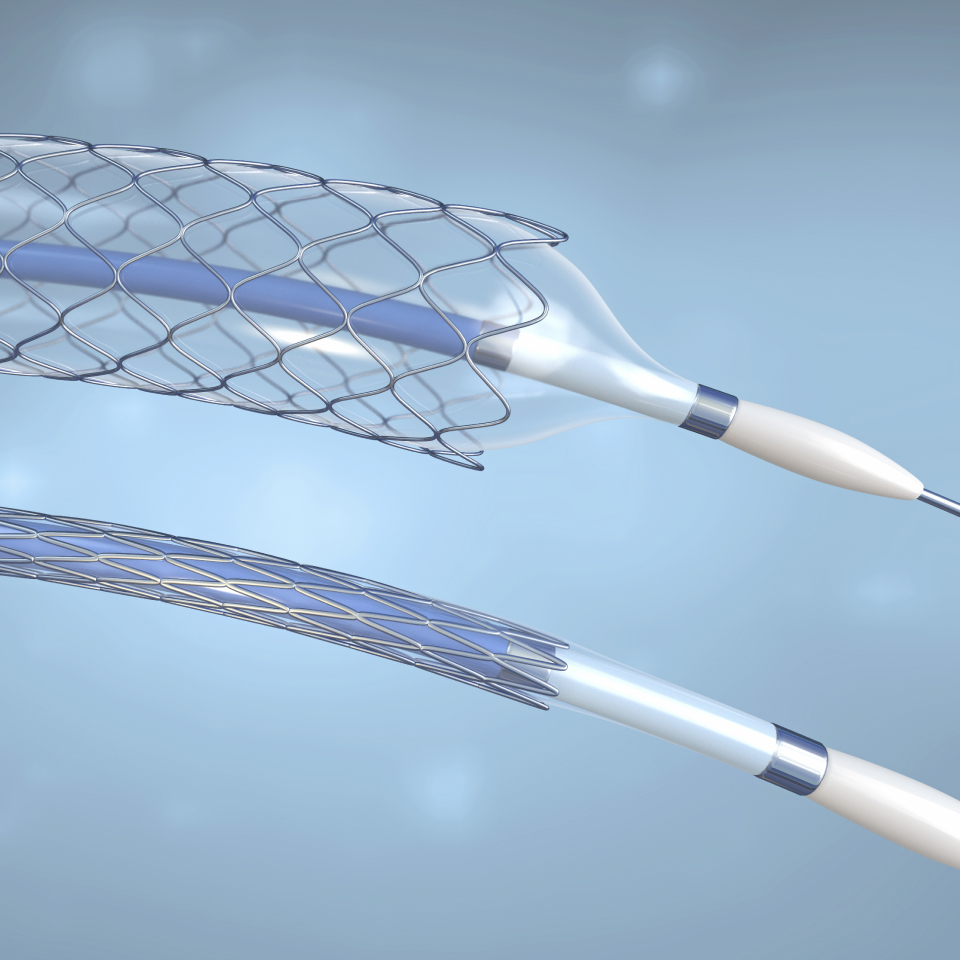 血管形成術の変遷