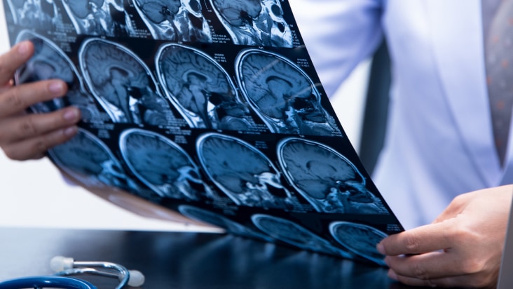 脳血栓回収療法実施医